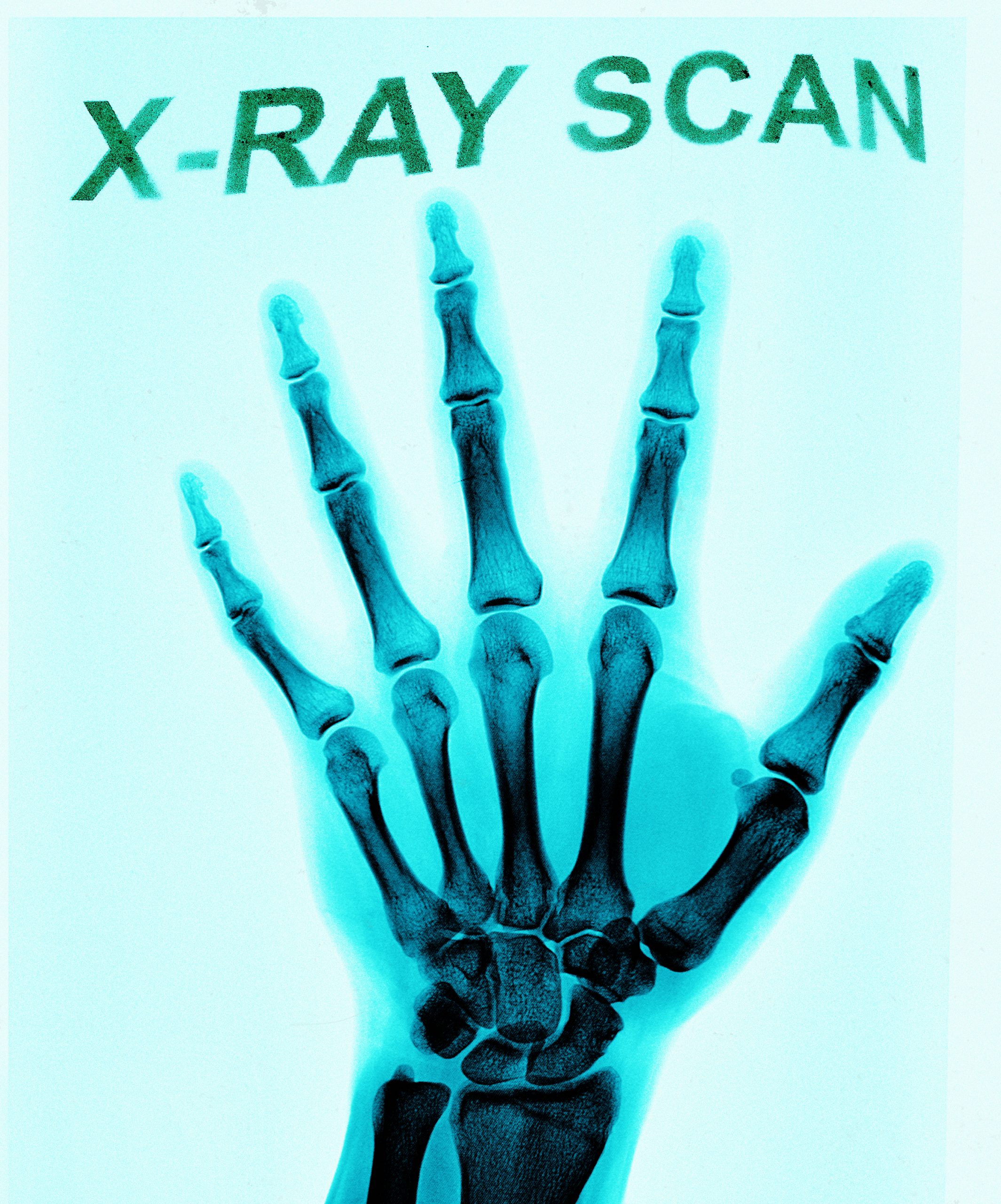 X-ray scan photoshop action Undyed creative studio